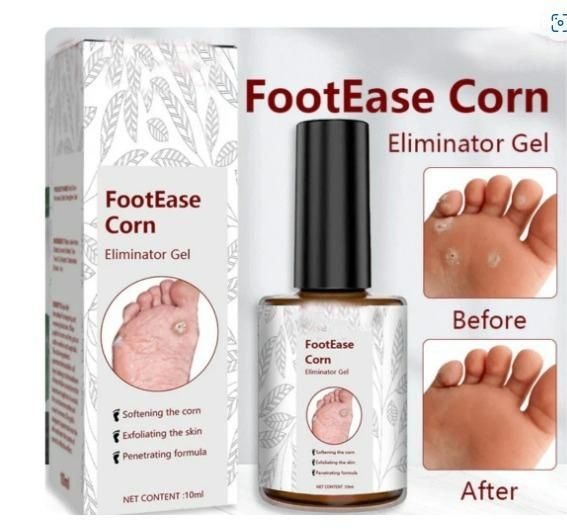 Feet Corn Removal Serum 30ml (BUY 1 GET2)
