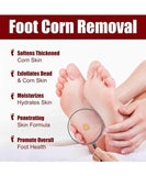 Feet Corn Removal Serum 30ml (BUY 1 GET2)
