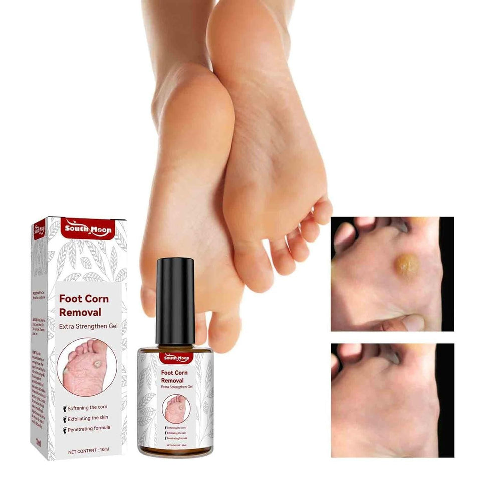 Feet Corn Removal Serum 30ml (BUY 1 GET2)