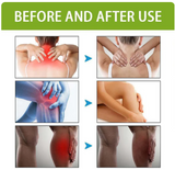 BeeTherapy™ #1 Bee Venom Pain Relief Cream | Buy 1 Get 4🔥